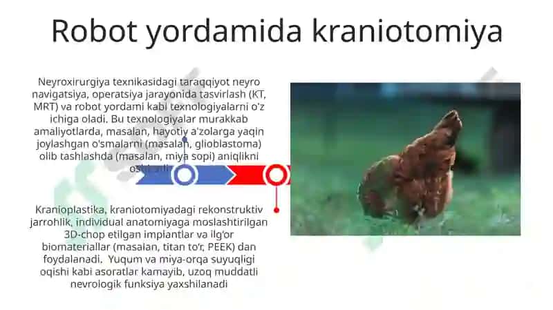 Minimal Invaziv Kraniotomiya Texnikalari 3