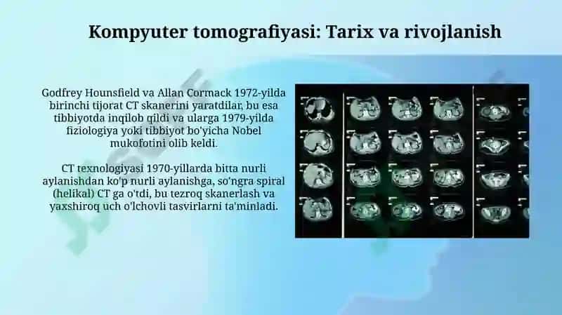 Kompyutertomografiyasi 3