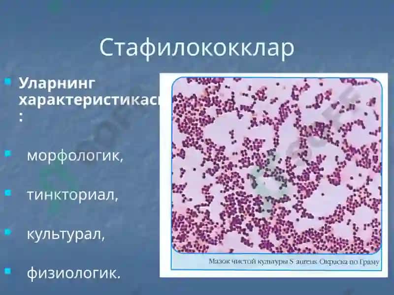 Йирингли яллиғланиш жараёнларини келтириб чиқарувчи микроорганизимлар. 3