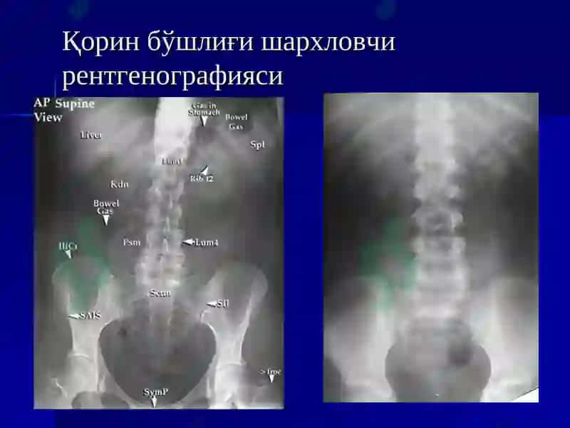 Ошқазон ичак касалликларида нур текшириш усуллари 3