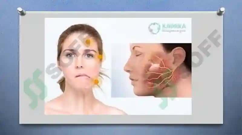 Neuritis 3
