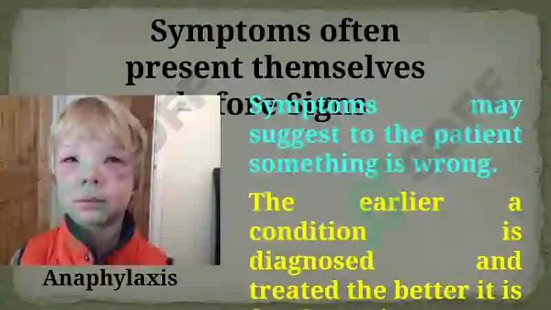 Signs and Symptoms 3