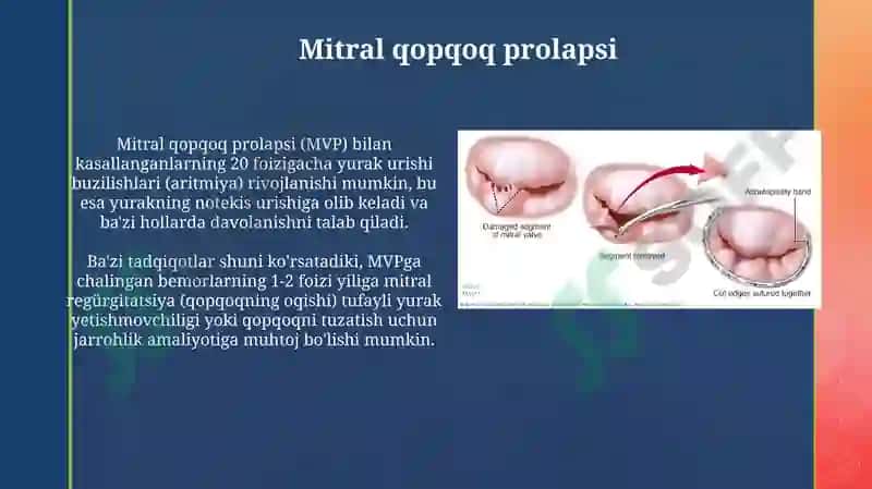 Mitral qopqoq prolapsi 3