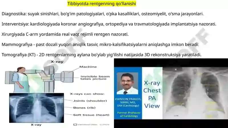 Rentgen_nurlarini_o'rganish_tarixi,_suyak_va_bo'g'imlar_rivojlanishini 3