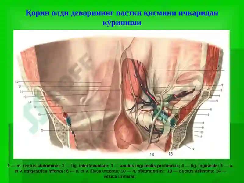 Чов, сон, киндик ва қорин оқ чизиғи чурралари 3