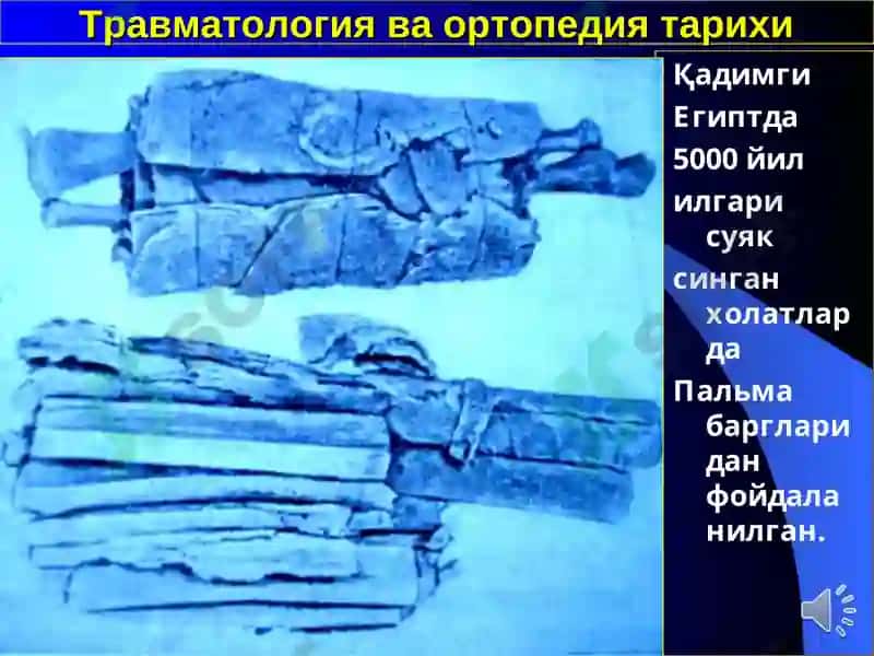 Травматология ва ортопедия 3