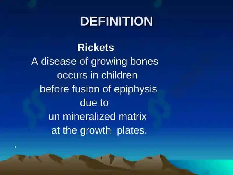 Rickets 3