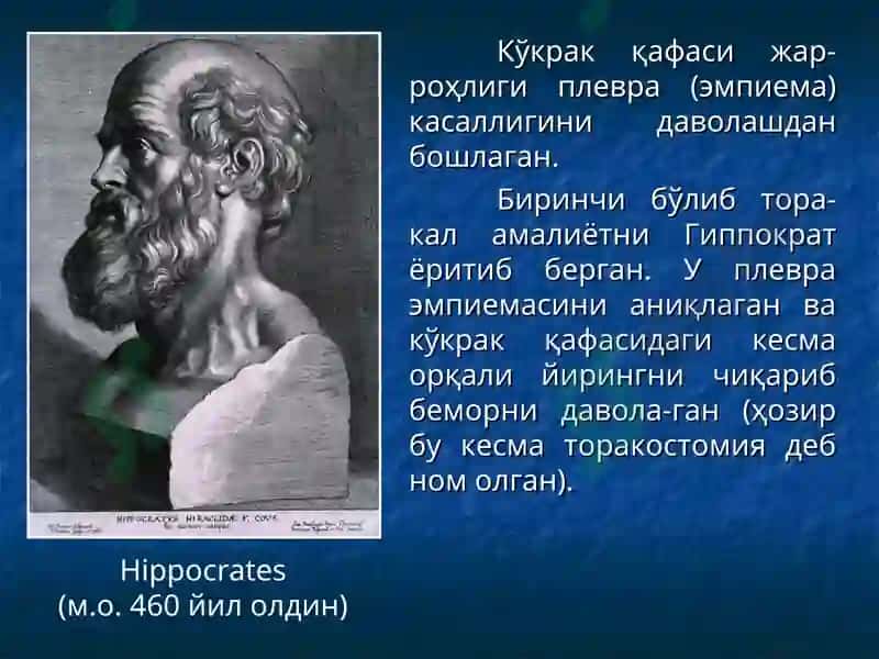 Плевра касалликлари 3