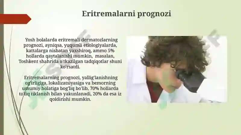Eritmalar haqida tushuncha, sinflanishi, konsintiratsiyasi 3