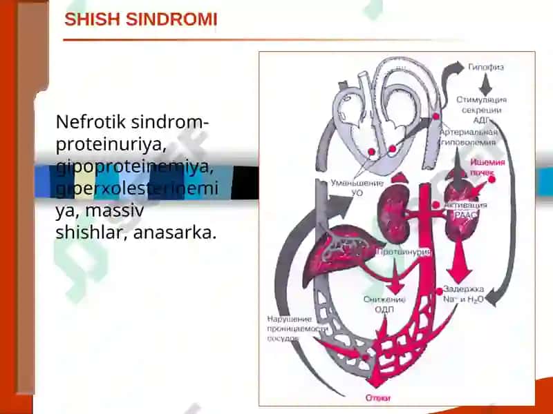 BUYRAK KASALLIKLARI SINDROMLARI. O‘TKIR VA SURUNKALI GLOMERULONEFRIT VA PIYELONEFRITLAR DIAGNOSTIKASI 3