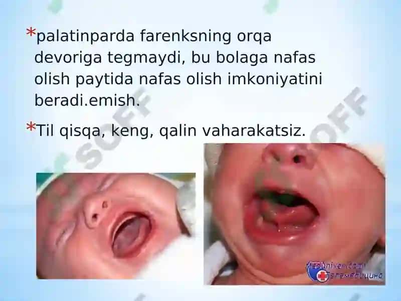 Bolalarda ovqat hazm qilish tizimining anatomik va fiziologik xususiyatlari 3