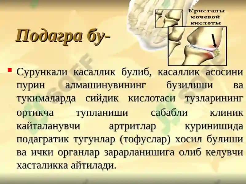 ПОДАГРА 3