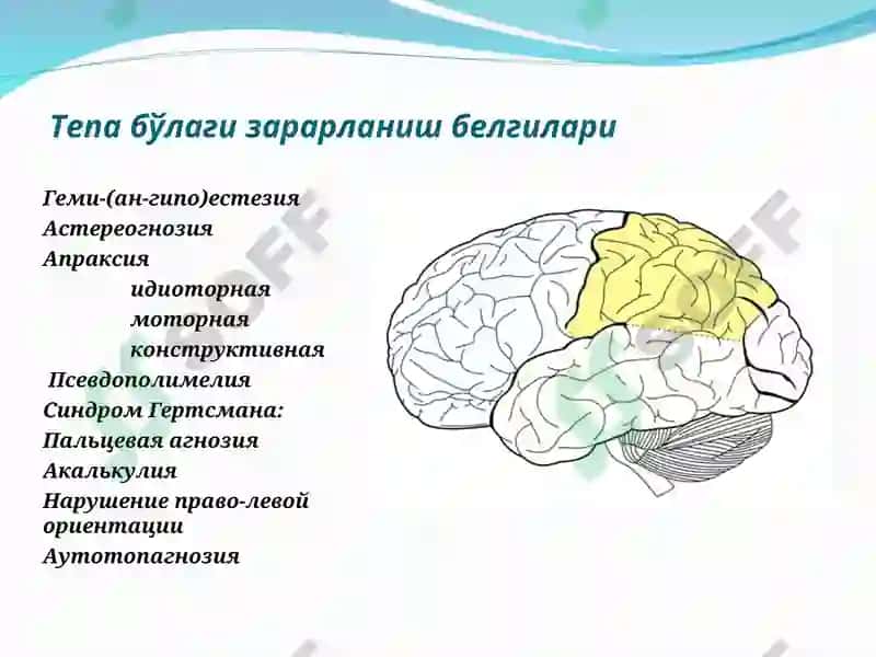 Бош мия ўsmалари 3