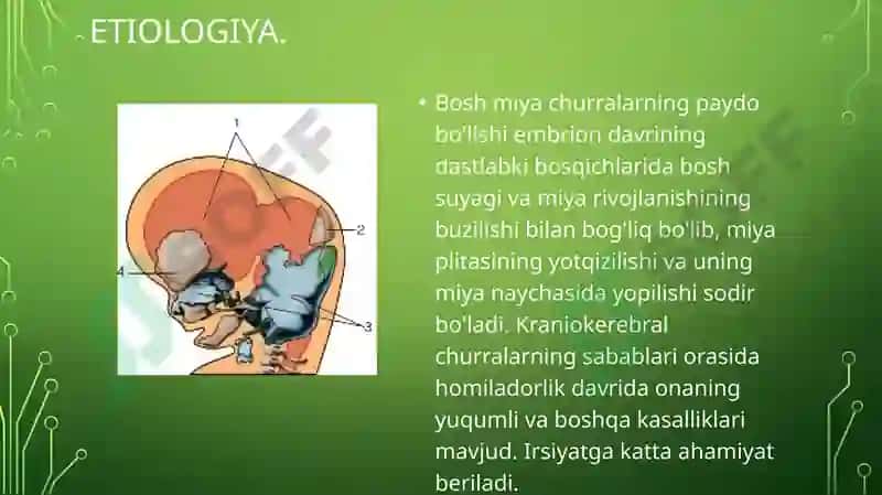 TUG'MA NUQSONLAR. BOLALARDA MIYA CHURRASI VA YURAK NUQSONLARI 3