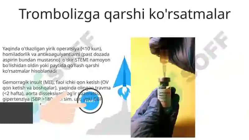 Trombolitik vositalar va mexanizmlar 3