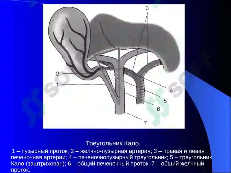 Постхолецистэктомический синдром 3