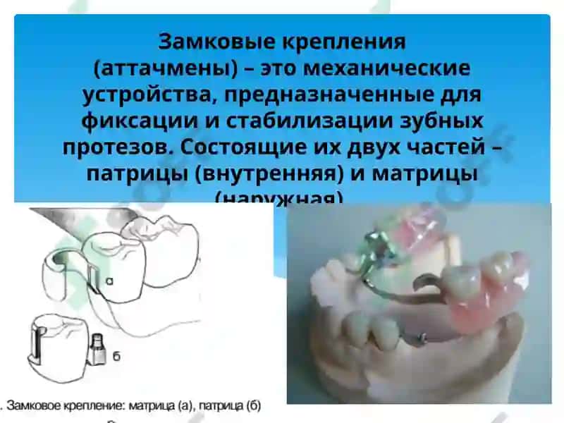 Аттачменлар 3