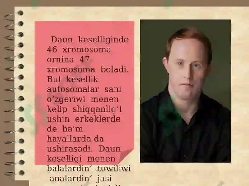 Daun Sindromi 3