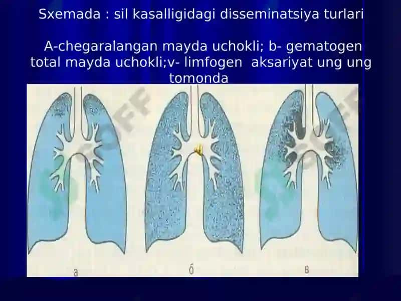 TARQOQ SIL 3