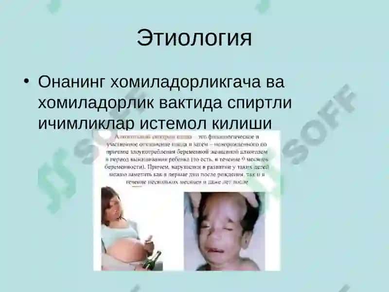 ЯНГИ ТУГУЛГАН БОЛАЛАРДА АЛКОГОЛЬ КАСАЛЛИГИ 3