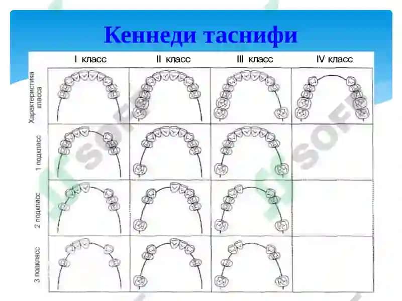 Таянч тишларга булган талаблар 3