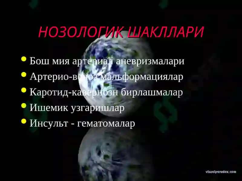 Бош мия кон-томир касалликлари 3
