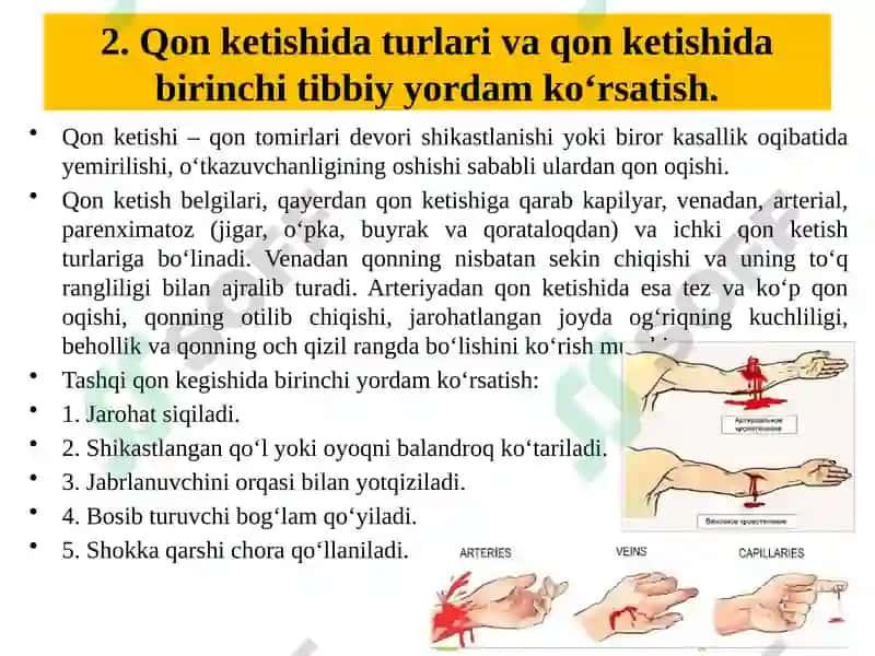 Qonketishida tibbiy yordam ko‘rsatish 3