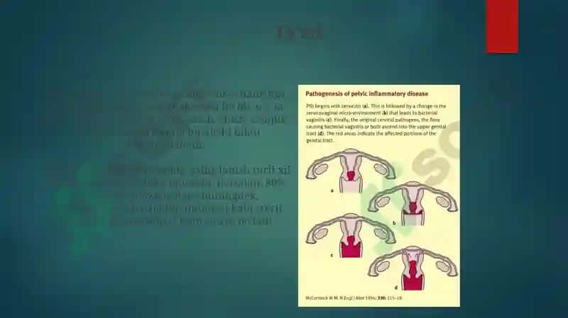 Ayollarjinsiytizima'zolariyallig'lanishjarayoninipatofiziologiyasi 3