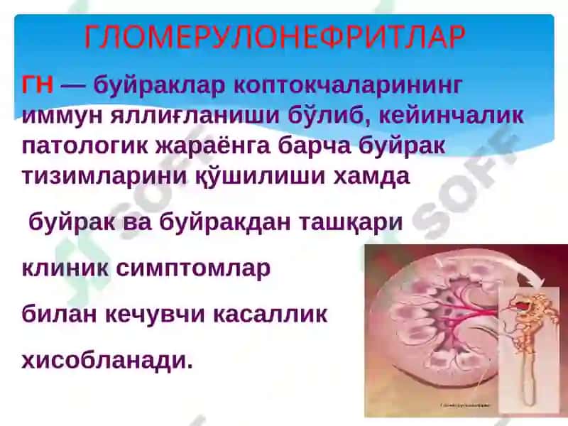 Гломерулонефритлар 3