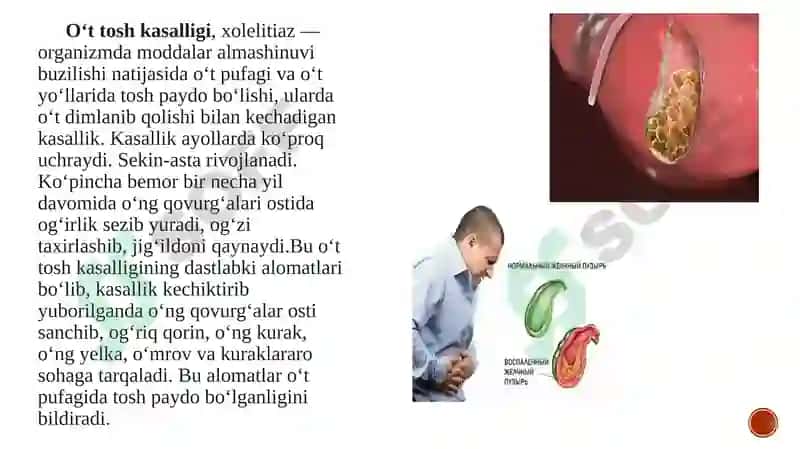 Oʻt tosh kasalliklari va uning sabablari 3