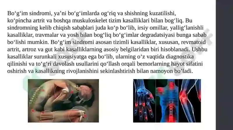 Bo’g’im sindromi haqida ma’lumot 3