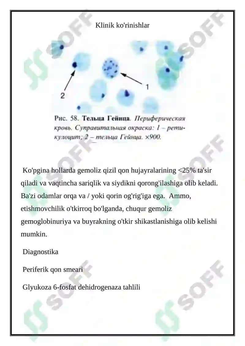 NASLIY MIKROSFEROSITOZ. G-6-FDG DEFITSIT ANEMIYA LABORATOR DIAGNOSTIKASI 3