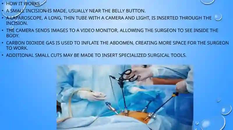 Laparoscopic Surgery. Laparoscopic Splenectomy. Surgery of the Pancreas. Biliodigestive Anastomose 3