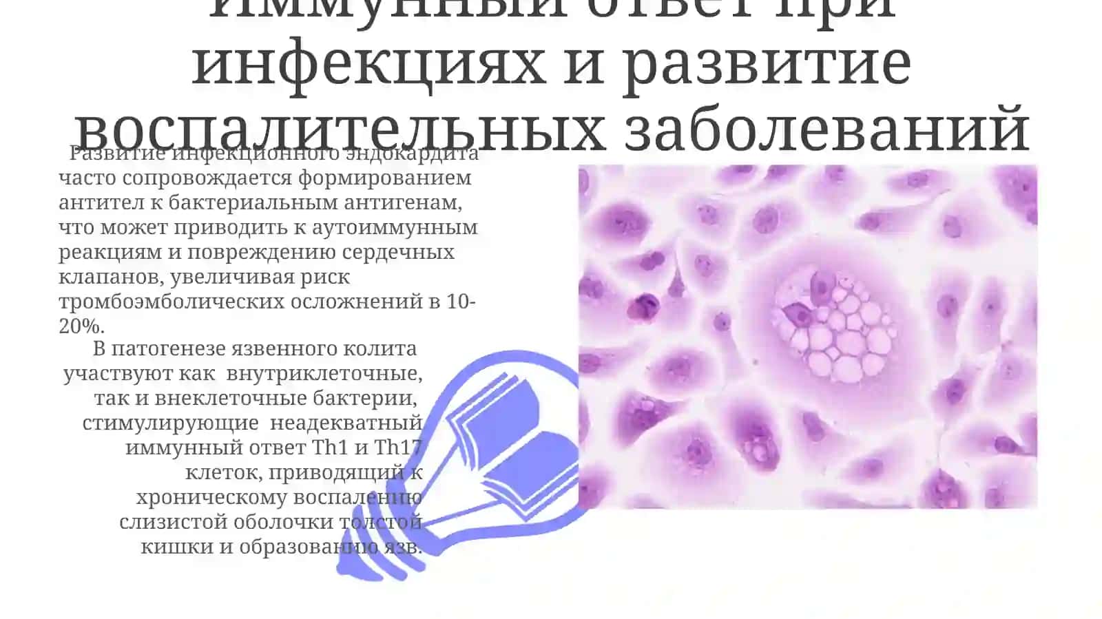 Значение микроорганизмов в происхождении гломерулонефрита, эндокардита, язвенного колита 3