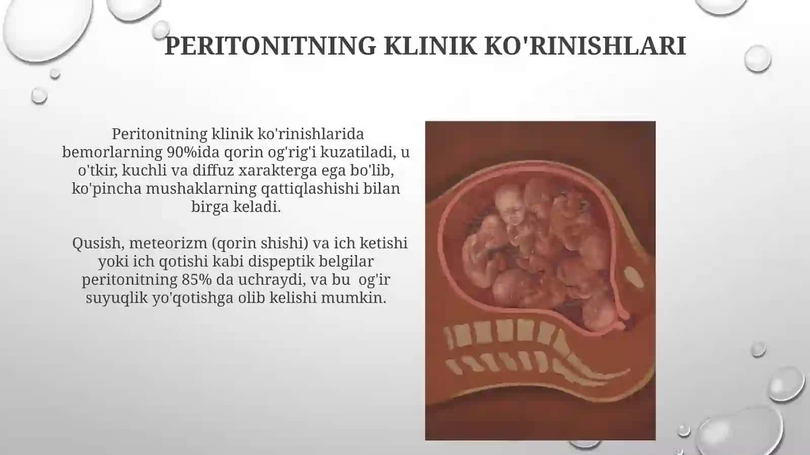 Òtkir ichak tutilishi va peritonitlar 3