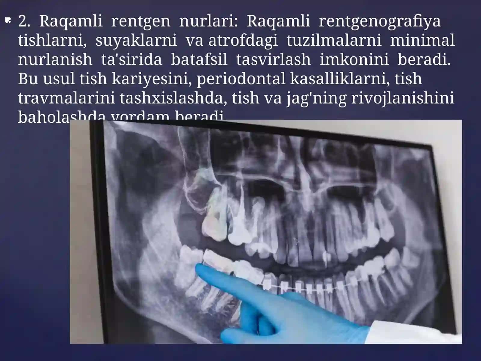 Stomatologik bemorlar kariesni tekshiradi 3