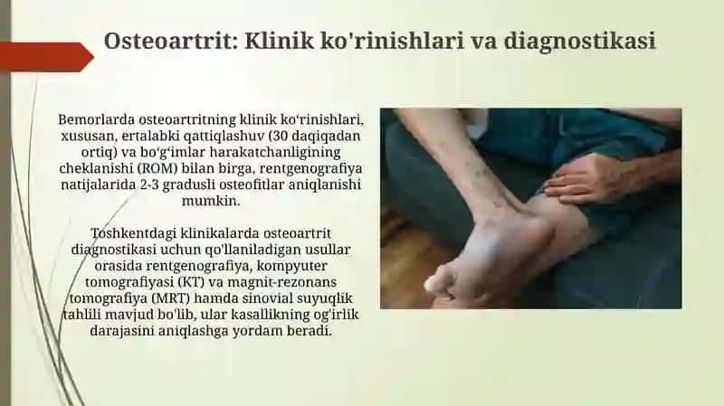Osteoartrit: Klinik ko'rinishlari va diagnostikasi 3