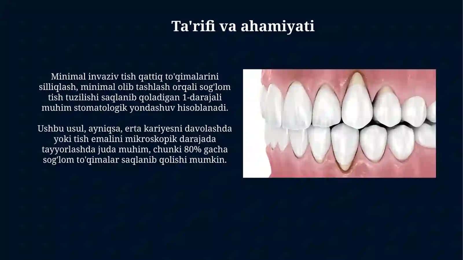 Tish qattiq to'qimasini chixlashning minimal invaziv usullari 3