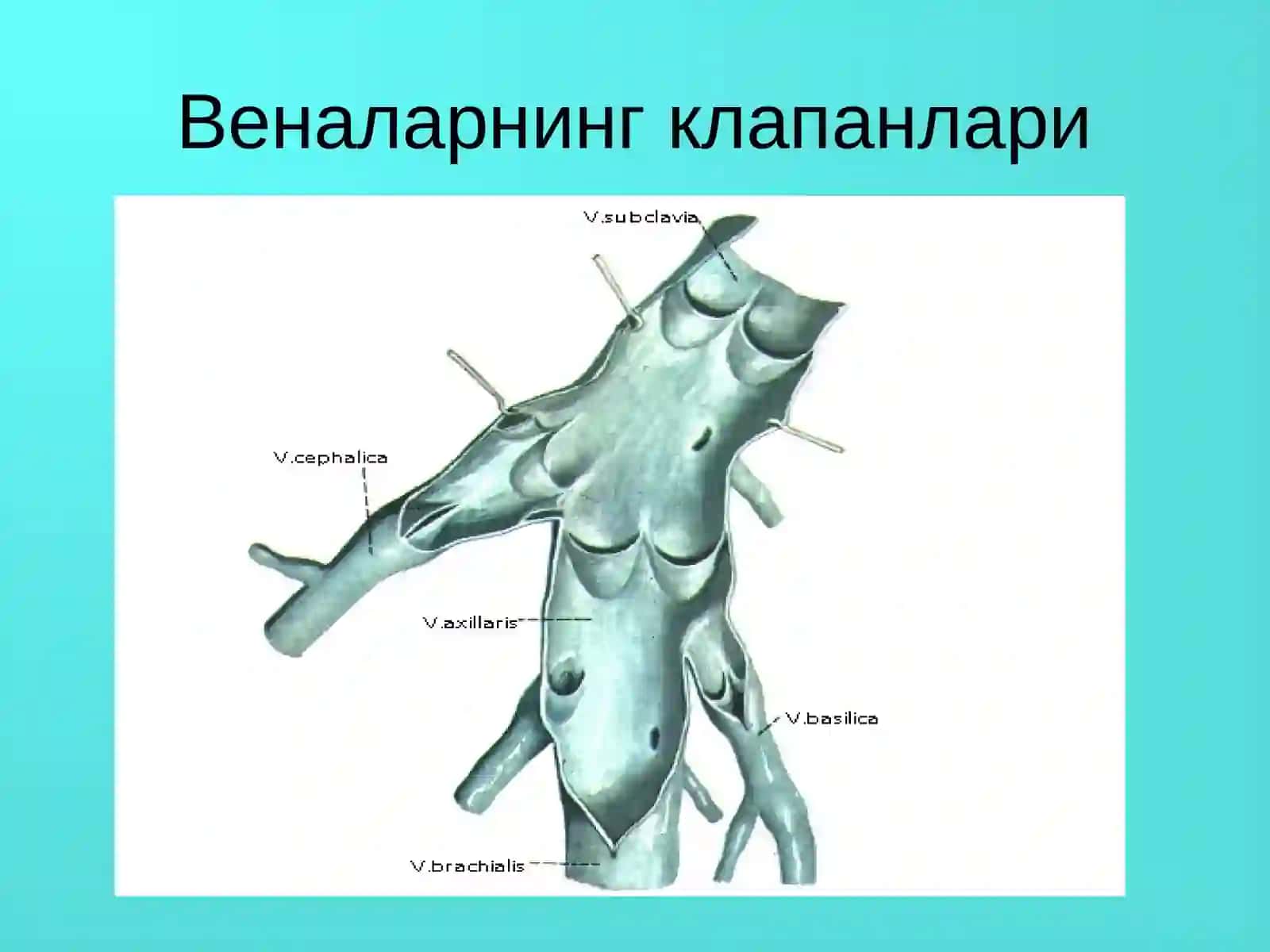 varikoz kasalligi 3