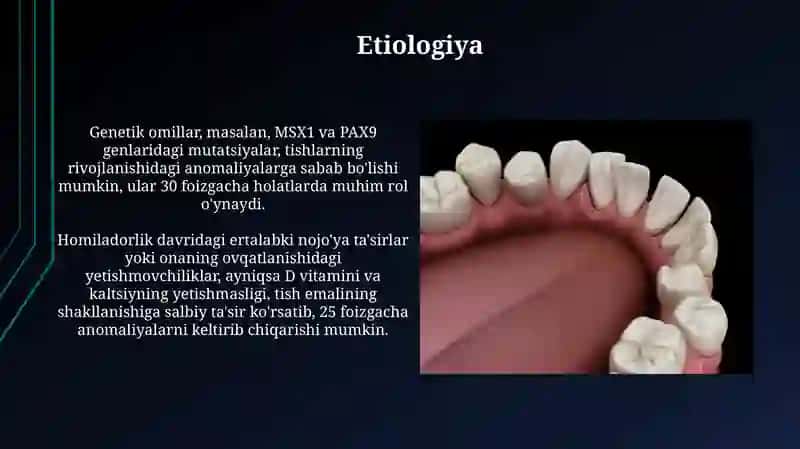 Tishlash va tishlarning rivojlanishidagi anomaliyalar 3