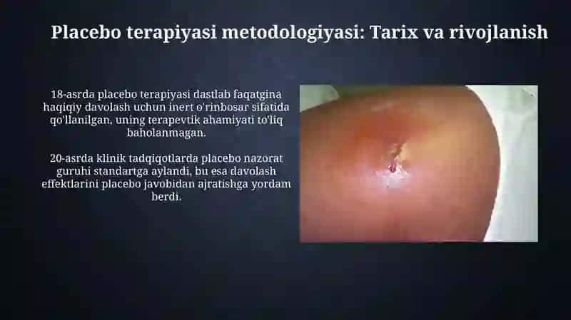 Placebo terapiyasi metodologiyasi 3