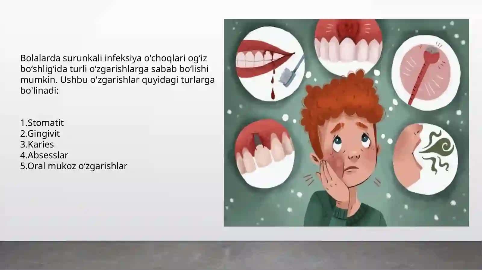 Bolalardagi surunkali infeksiya o'choqlarida og'iz bo'shlig'idagi o'zgarishlar 3