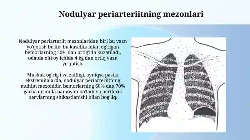 Tugunchali periartrit va nospetsifik aortaarterit kasalligining mezonlari, davolash va profilaktiks 3