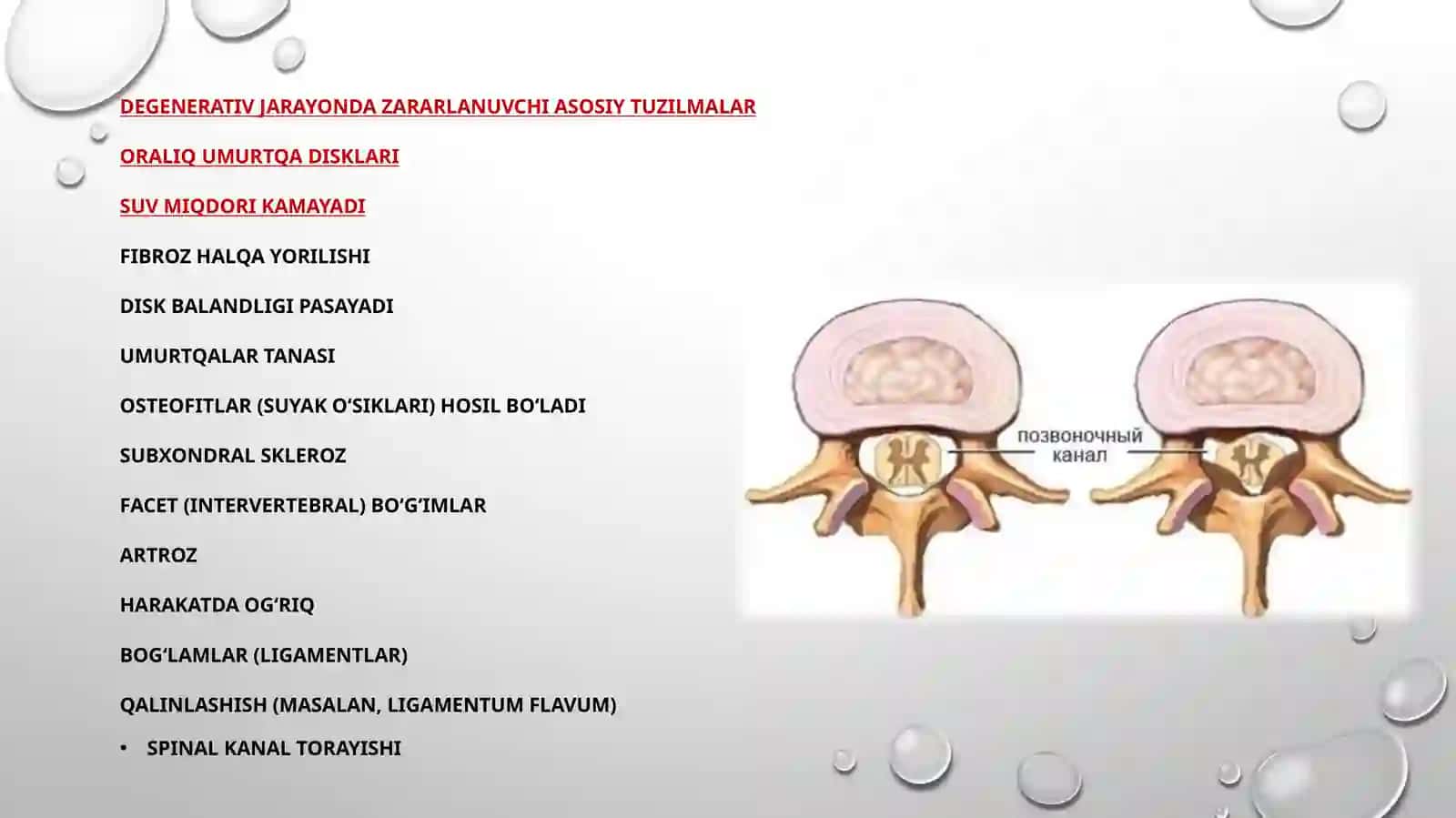 Umurtqapogonasidegenerativkasalliklarini zamonaviyjarroxlikdavolash usullari 3