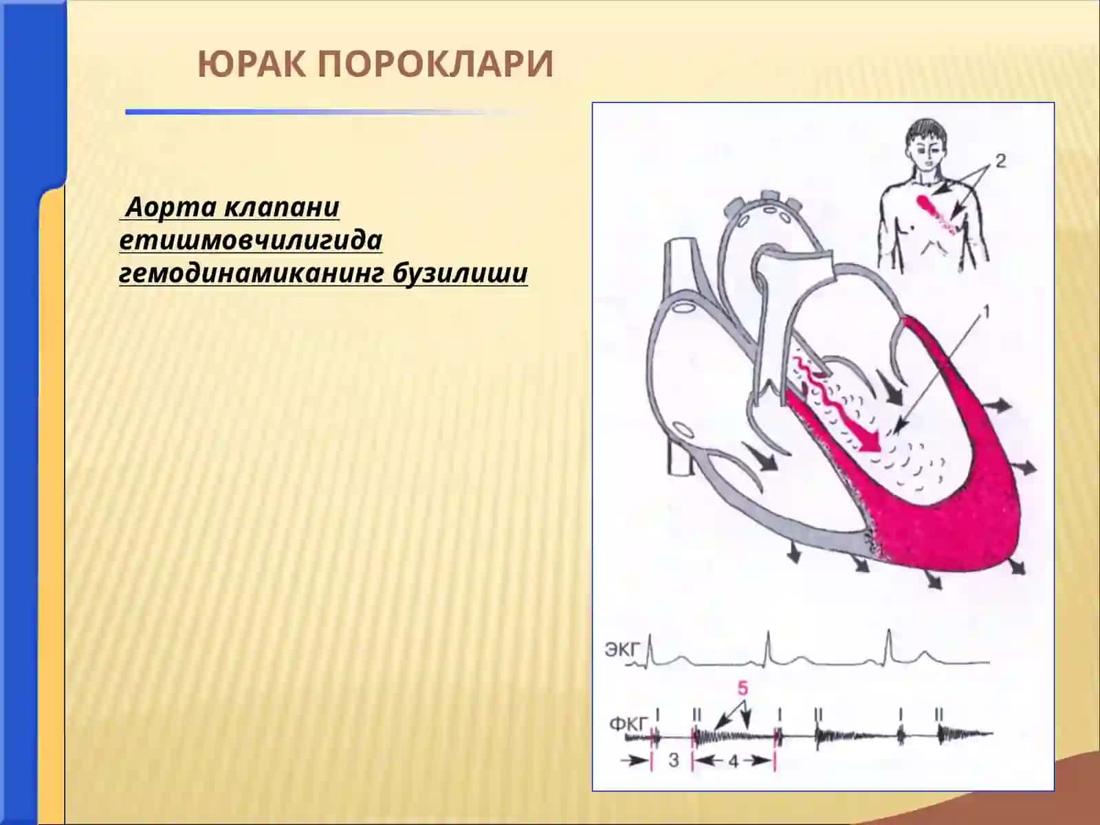 юрак  пороклари 3