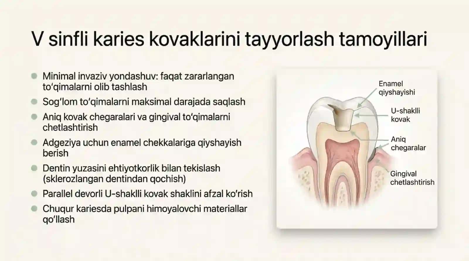 Blek boʻyicha V , VI sinfli karies kovaklarini restovratsiya qilishning klinik tamoyillari 3