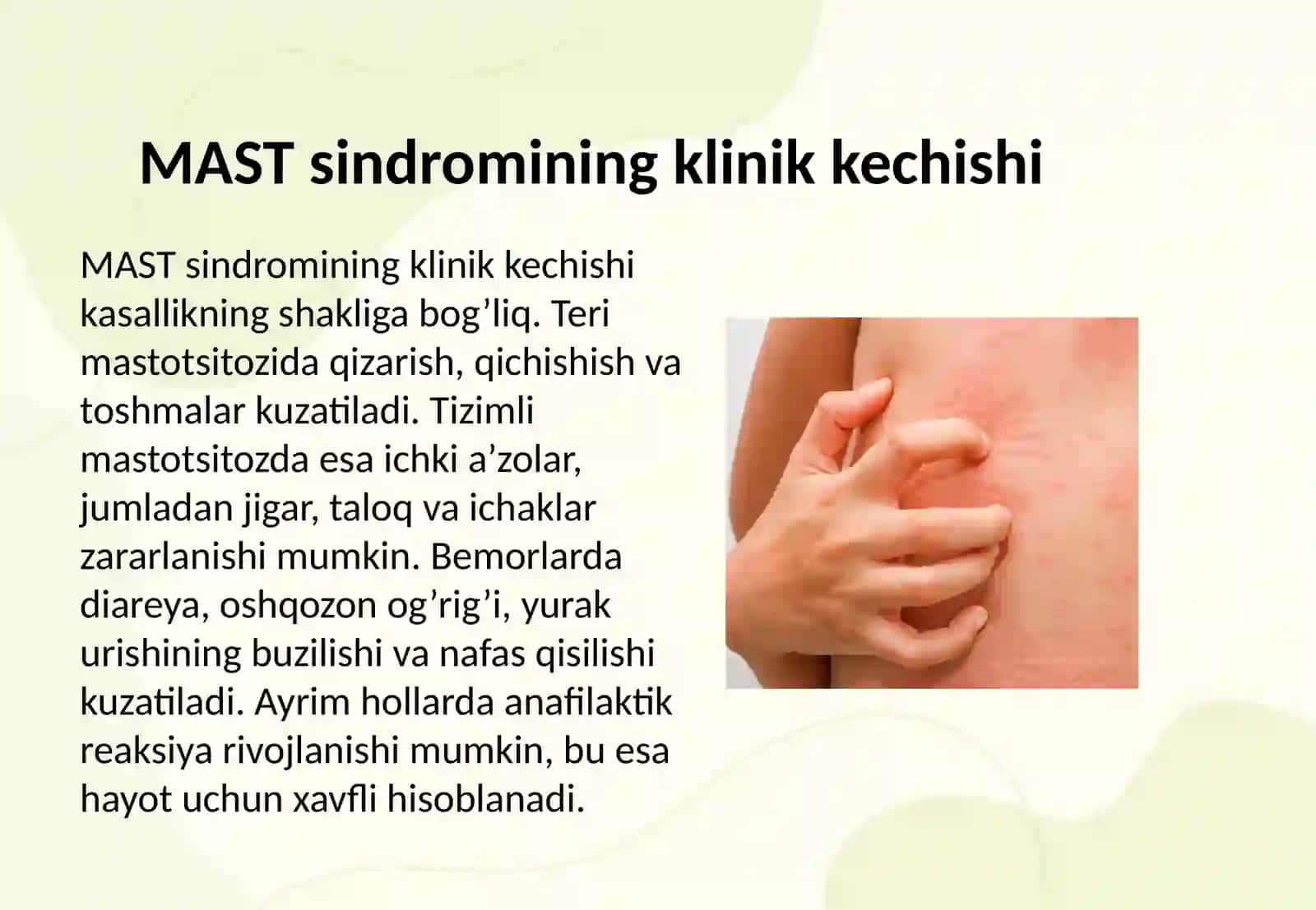 MAST sindromi klinik kechishi, EKG belgilari. Medikamentoz va nomedikamentoz davolash 3