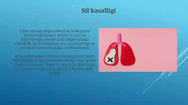Oʻpka epidemiyasi kasalliklari 3
