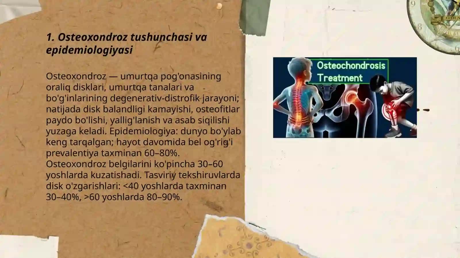 Osteoxondroz. Osteoxondroz bosqichlari.Umurtqasi pog onasining manual tekshiruv priyomlari 3