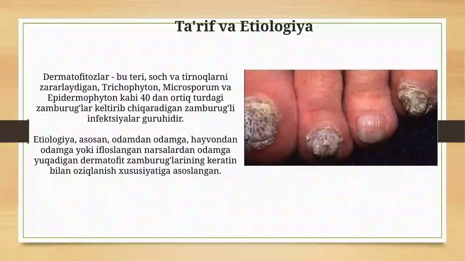 Mikozlar klasifikatsiyasi dermatamikozlar 3